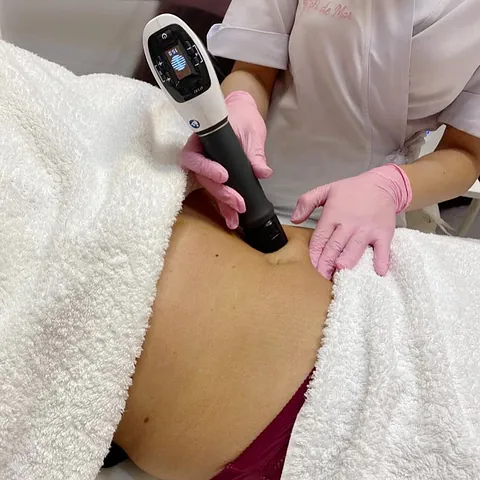 Tati De Mar tratamiento facial